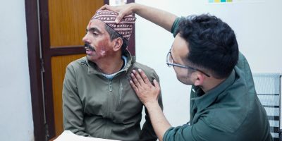 सुर्खेतमा भोलिदेखि ‘नबिल निःशुल्क जलन उपचार शिविर’